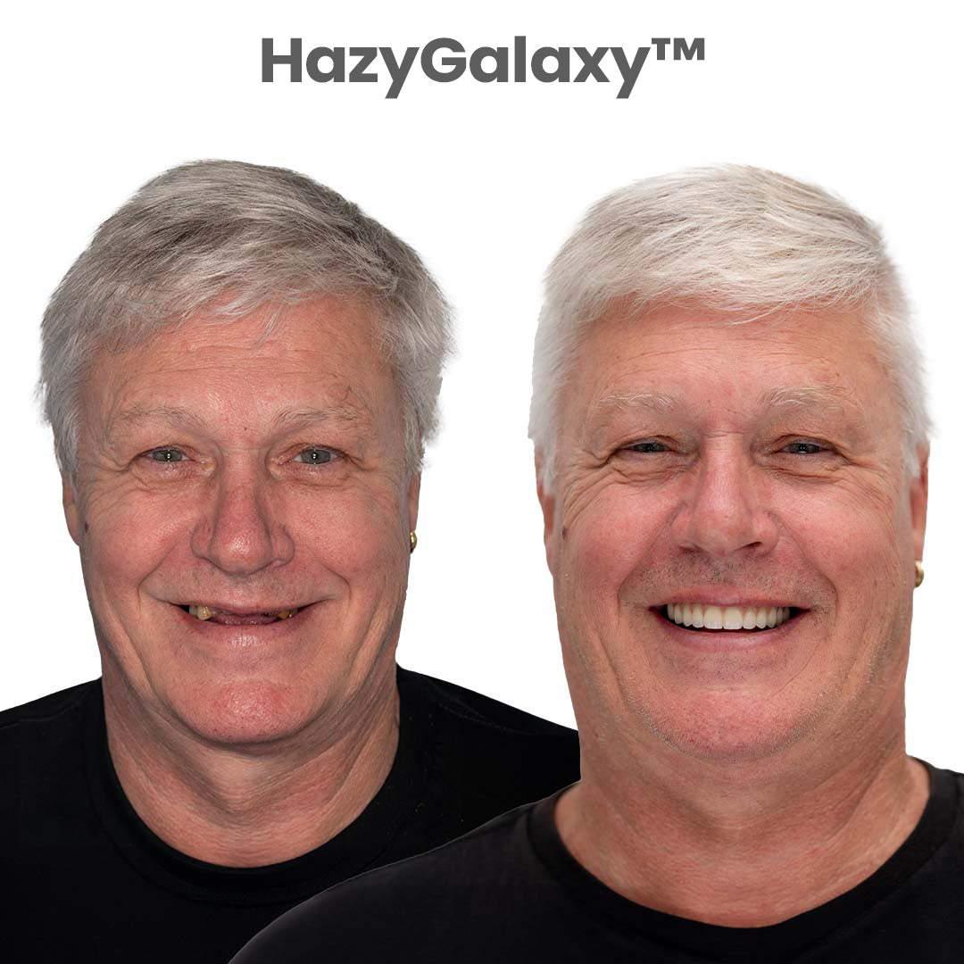 ✅🦷 HazyGalaxy™ Custom-Fit Dentures ⏰ ENDS TODAY 70% OFF | Smile with Confidence