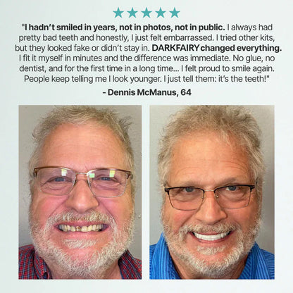 💥DarkFairy™ Custom-Fit Dentures — Designed for Comfort and a Natural-Looking Smile