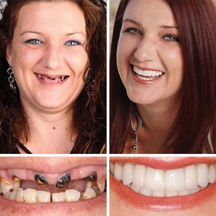 ⚡ 🌎Ends Today: 70% OFF! ⏰ Medical Full Denture with Strong Suctiond